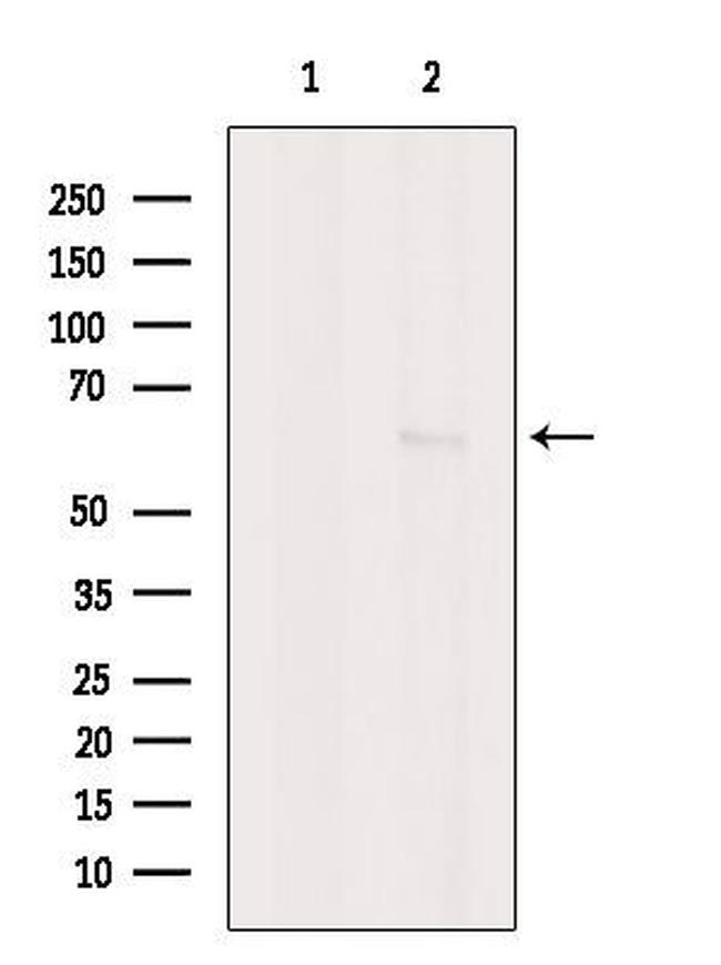 CaMKII beta/gamma Antibody in Western Blot (WB)