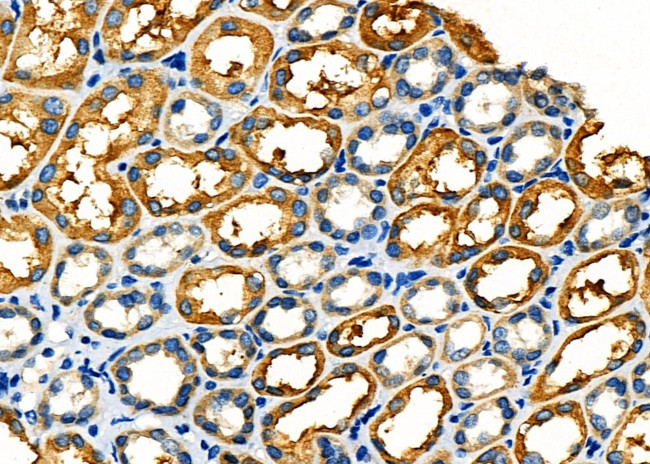 DNAI1 Antibody in Immunohistochemistry (Paraffin) (IHC (P))