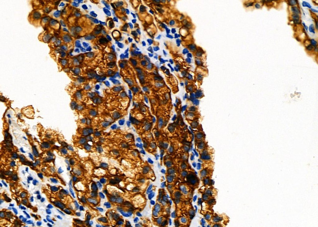 DNAI1 Antibody in Immunohistochemistry (Paraffin) (IHC (P))