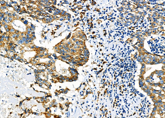 GSPT1 Antibody in Immunohistochemistry (Paraffin) (IHC (P))