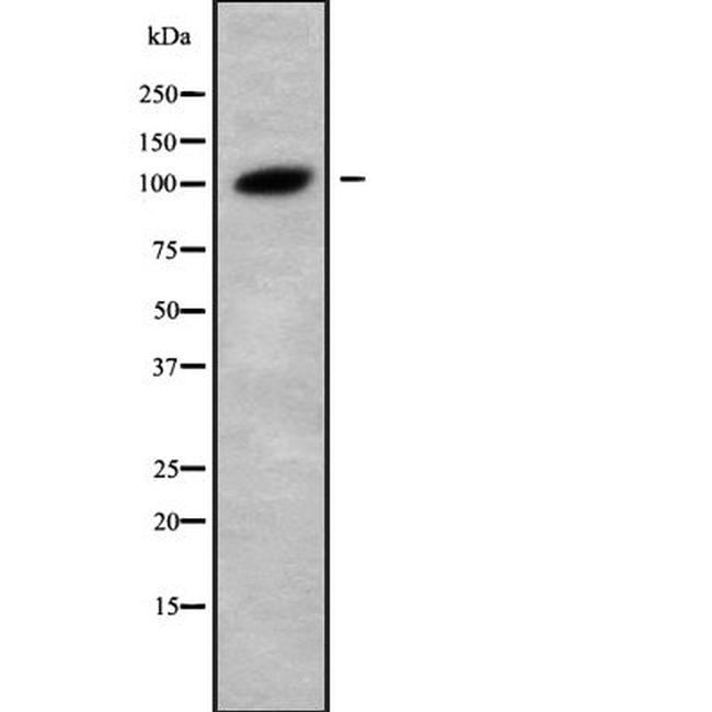 GANAB Antibody in Western Blot (WB)