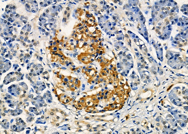 GPRC5C Antibody in Immunohistochemistry (Paraffin) (IHC (P))