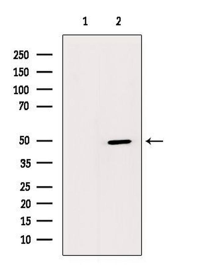 GPRC5C Antibody in Western Blot (WB)