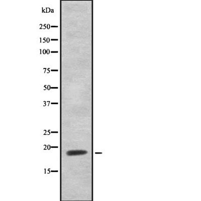 HEN1/HEN2 Antibody in Western Blot (WB)