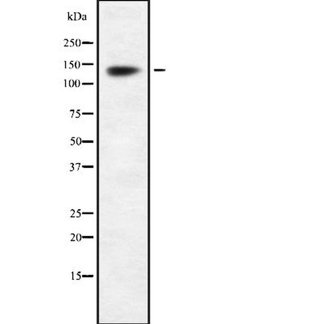 INTS2 Antibody in Western Blot (WB)