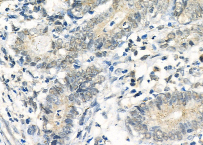 DUSP4 Antibody in Immunohistochemistry (Paraffin) (IHC (P))