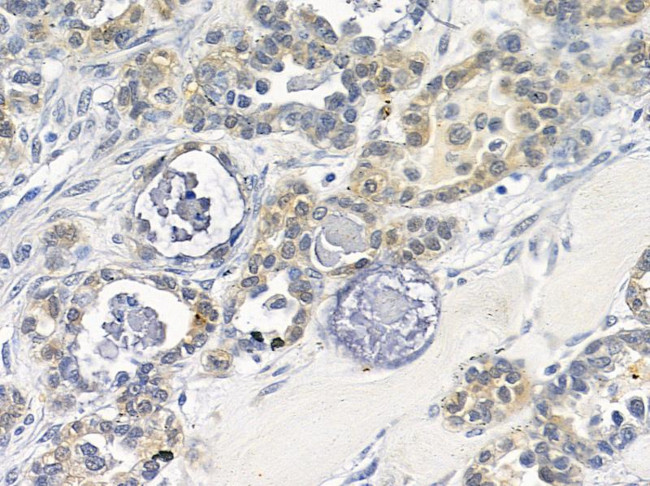 Nidogen Antibody in Immunohistochemistry (Paraffin) (IHC (P))