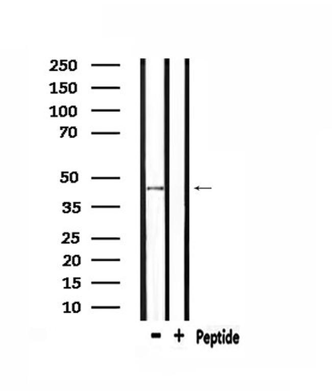 NMUR1 Antibody in Western Blot (WB)