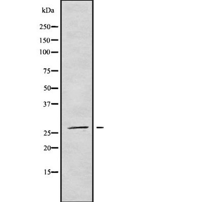 NRIP3 Antibody in Western Blot (WB)