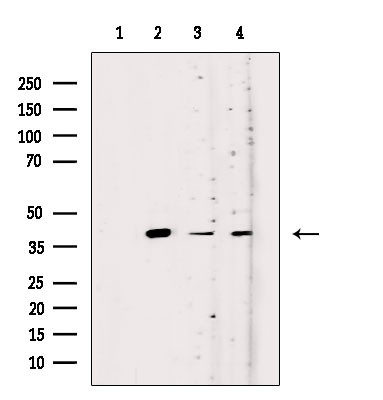 OR52K1 Antibody in Western Blot (WB)