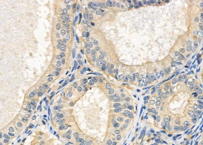 OLFML2B Antibody in Immunohistochemistry (Paraffin) (IHC (P))