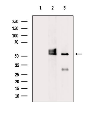 A26C2/A26C3 Antibody in Western Blot (WB)