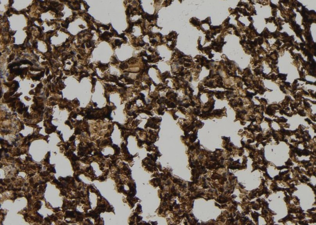 A26C2/A26C3 Antibody in Immunohistochemistry (Paraffin) (IHC (P))