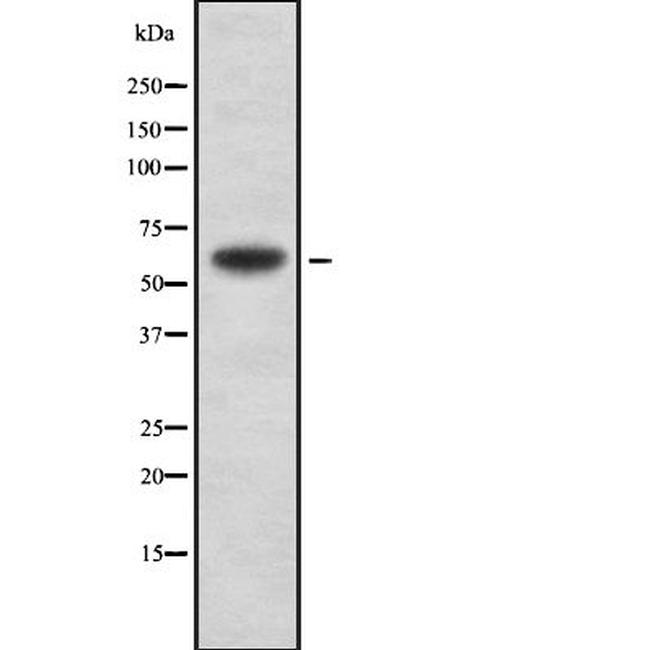 A26C2/A26C3 Antibody in Western Blot (WB)
