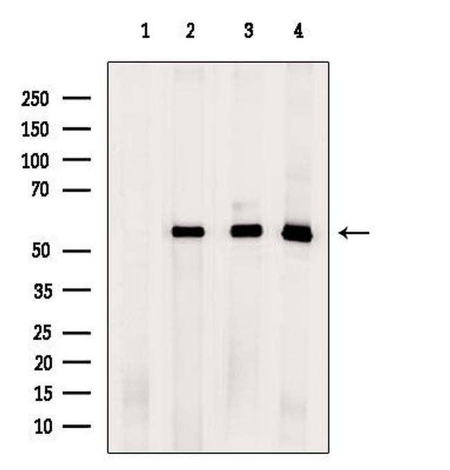 RAB3IP Antibody in Western Blot (WB)