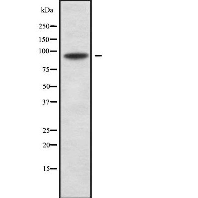 RFX3 Antibody in Western Blot (WB)