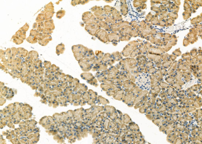 RPS2 Antibody in Immunohistochemistry (Paraffin) (IHC (P))