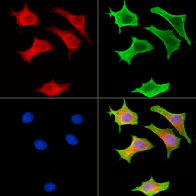 RSK4 Antibody in Immunocytochemistry (ICC/IF)