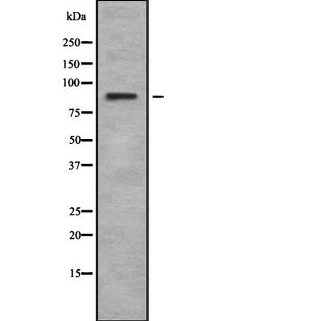 RSK4 Antibody in Western Blot (WB)