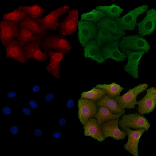 Separase Antibody in Immunocytochemistry (ICC/IF)