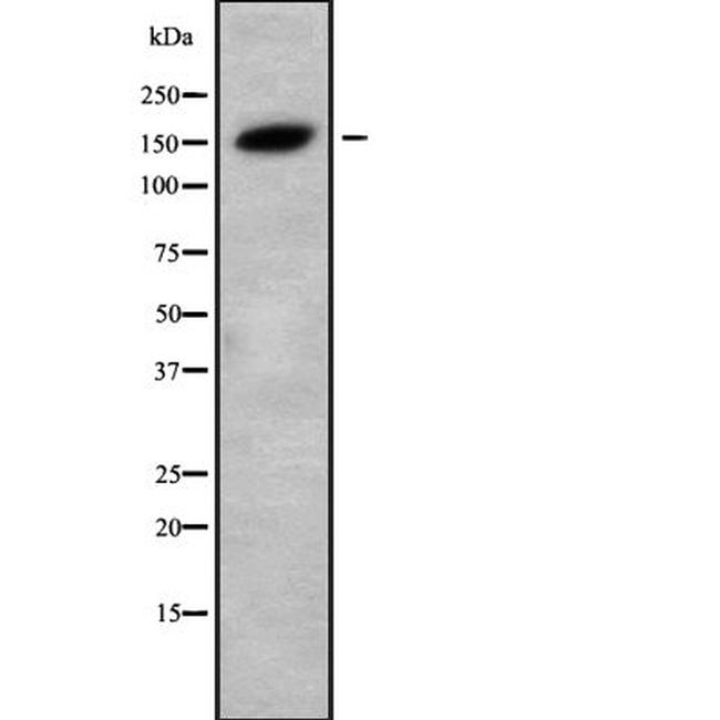 TAB182 Antibody in Western Blot (WB)