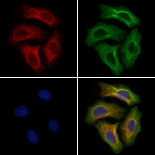 EVER2 Antibody in Immunocytochemistry (ICC/IF)