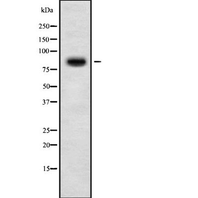 EVER2 Antibody in Western Blot (WB)