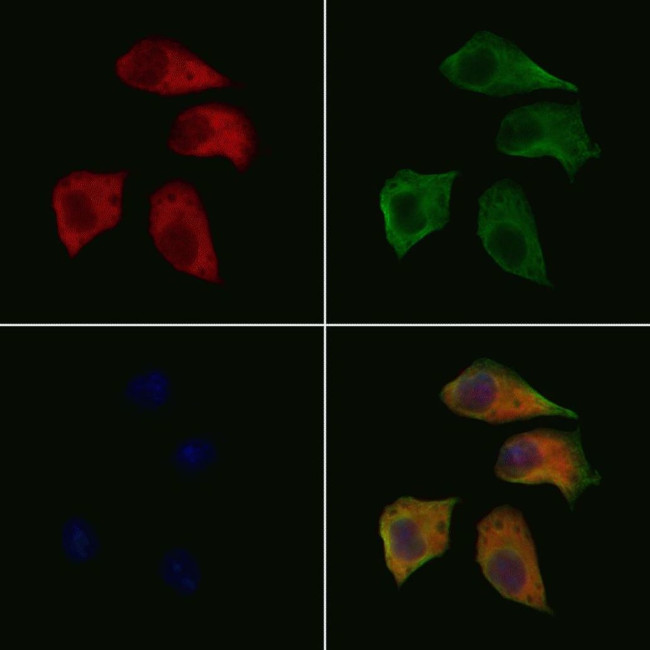 WAVE1 Antibody in Immunocytochemistry (ICC/IF)