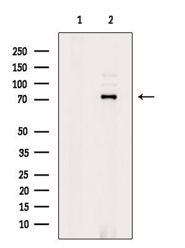 WAVE1 Antibody in Western Blot (WB)