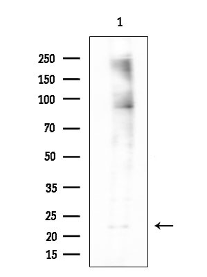 UBE2E3 Antibody in Western Blot (WB)