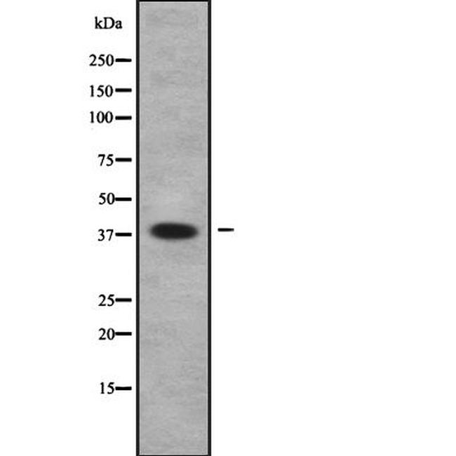 UBE2U Antibody in Western Blot (WB)