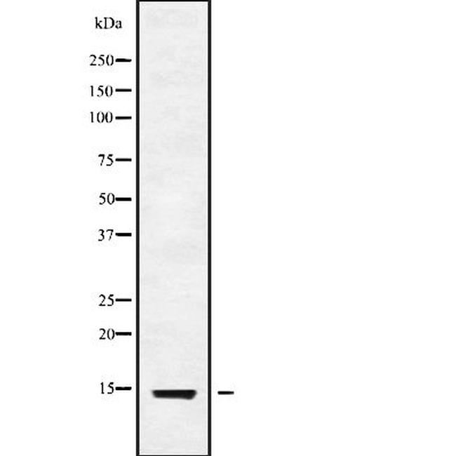 V-ATPase G3 Antibody in Western Blot (WB)