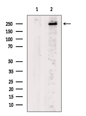 CaV3.1 Antibody in Western Blot (WB)