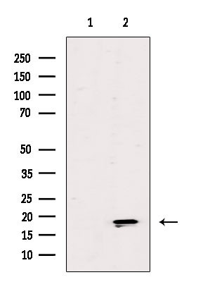 ZNHIT1 Antibody in Western Blot (WB)