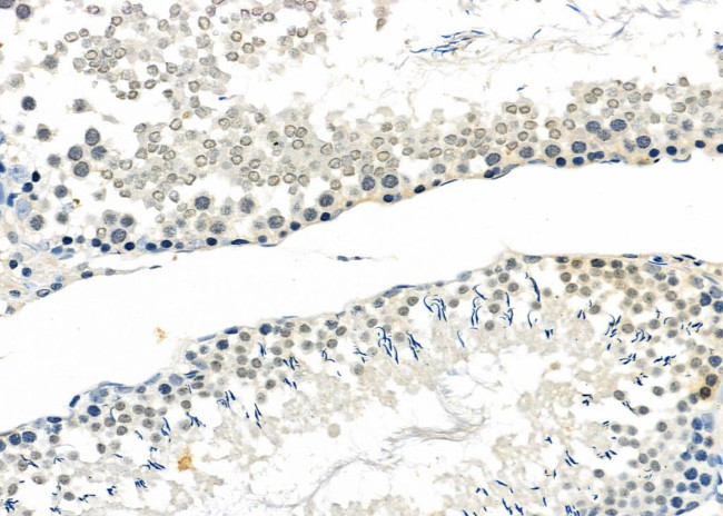 MAGEB3 Antibody in Immunohistochemistry (Paraffin) (IHC (P))