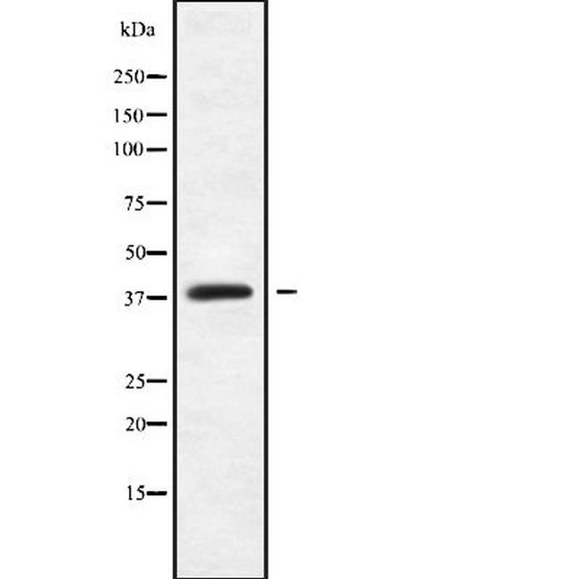 MAGEB18 Antibody in Western Blot (WB)