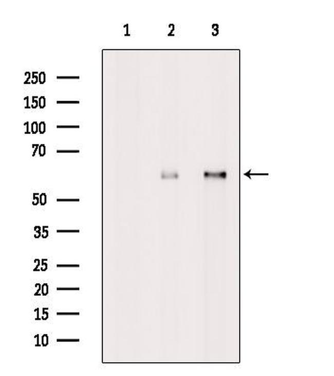 MAGEE2 Antibody in Western Blot (WB)