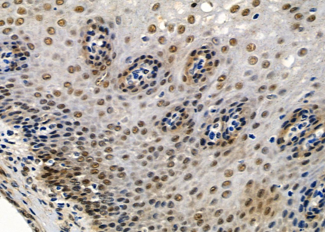 HEN2 Antibody in Immunohistochemistry (Paraffin) (IHC (P))