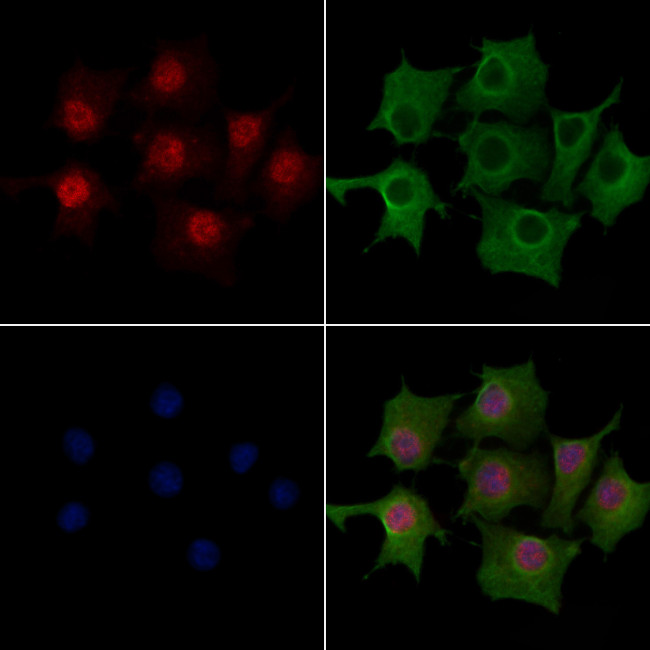 ATOH8 Antibody in Immunocytochemistry (ICC/IF)