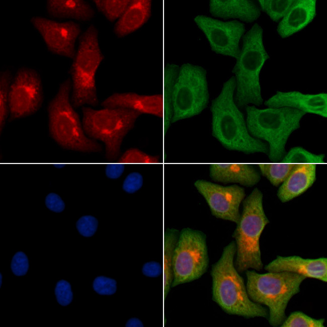 LARP2 Antibody in Immunocytochemistry (ICC/IF)