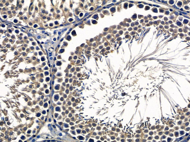 LARP2 Antibody in Immunohistochemistry (Paraffin) (IHC (P))