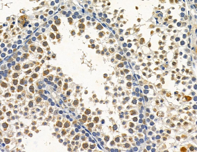 Cytomegalovirus UL97 Antibody in Immunohistochemistry (Paraffin) (IHC (P))