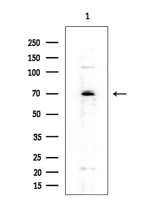 Cytomegalovirus UL97 Antibody in Western Blot (WB)