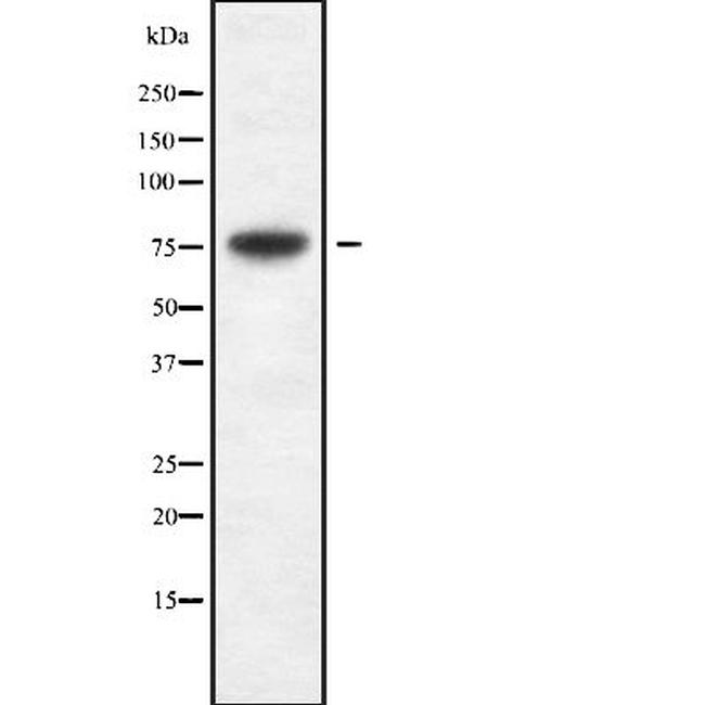 Cytomegalovirus UL97 Antibody in Western Blot (WB)