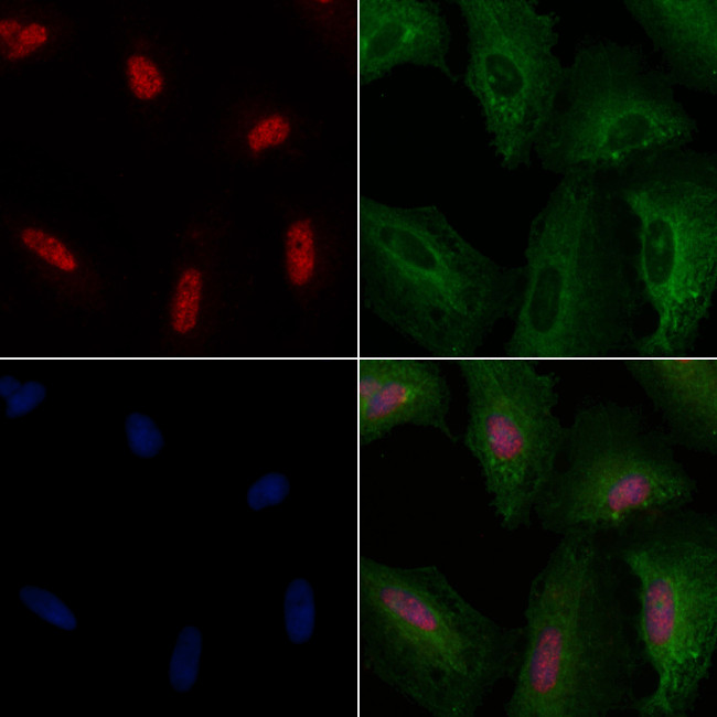 TRMT11 Antibody in Immunocytochemistry (ICC/IF)