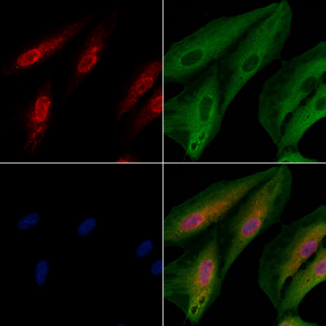 TRMT11 Antibody in Immunocytochemistry (ICC/IF)