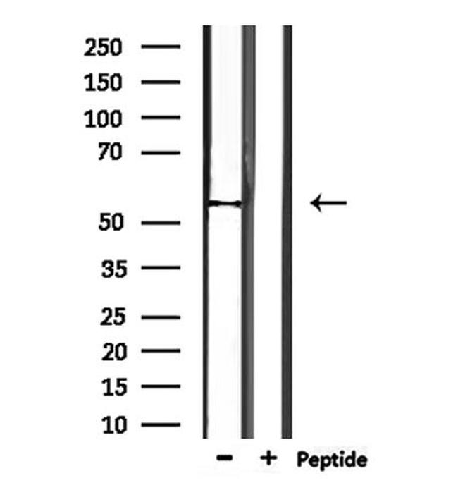 TRMT11 Antibody in Western Blot (WB)