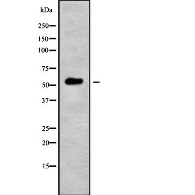 POLM Antibody in Western Blot (WB)