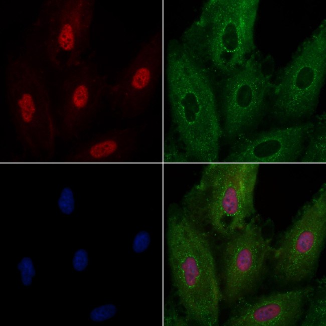 NOLA1 Antibody in Immunocytochemistry (ICC/IF)