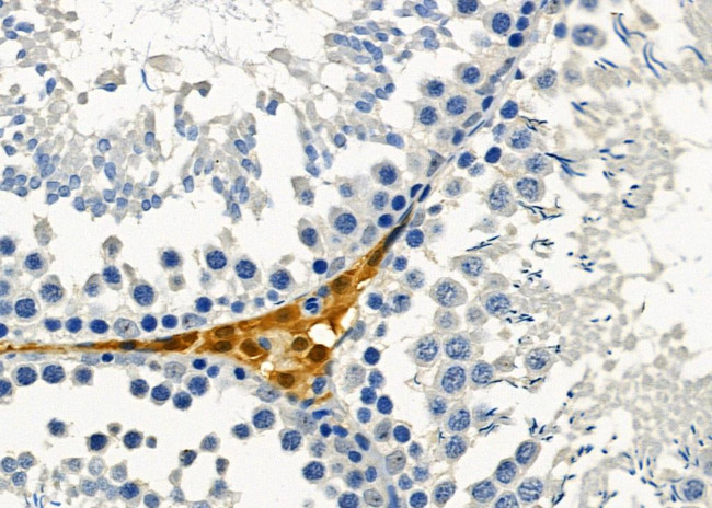 NOLA1 Antibody in Immunohistochemistry (Paraffin) (IHC (P))